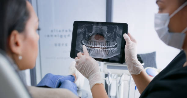 Licensed Tooth Extraction service in El Cerrito, CA - Smile Center Dentistry